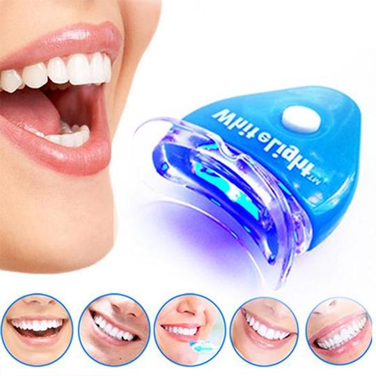 Kit blanchiment dentaire, l’offre idéale pour des dents blanchies
